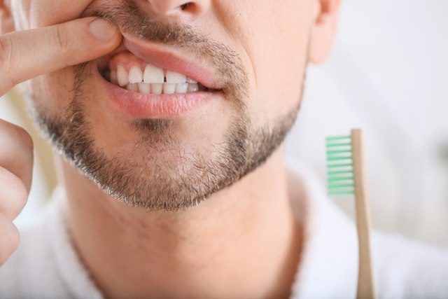 Kako da razlikujete bol zbog osetljivosti zuba od karijesa?